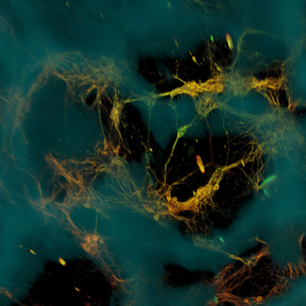 Microscopic image of neurons forming connections on a scaffold.