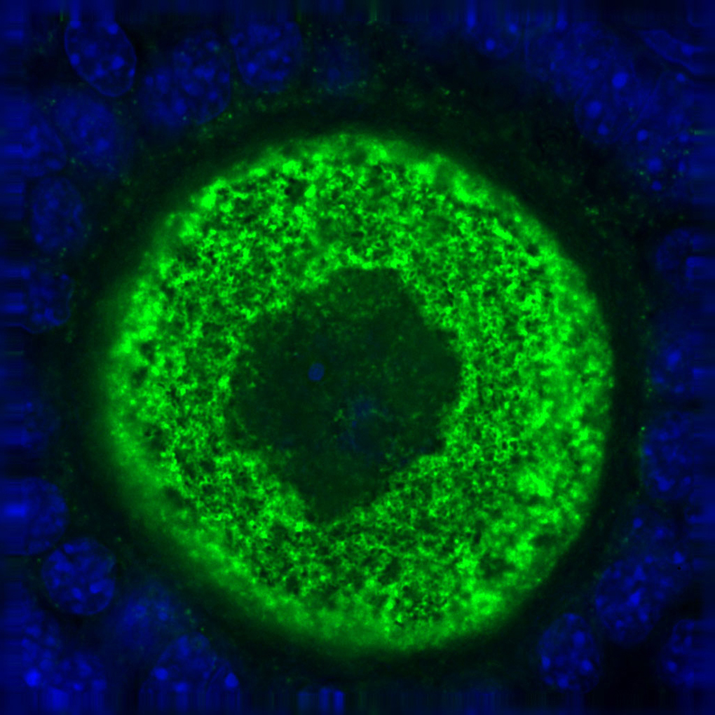 oocyt z wybarwionym białkiem ronin, źródło: National Institute of Biomedical Imaging and Bioengineering