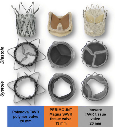 comparison of polymer and animal tissue valves
