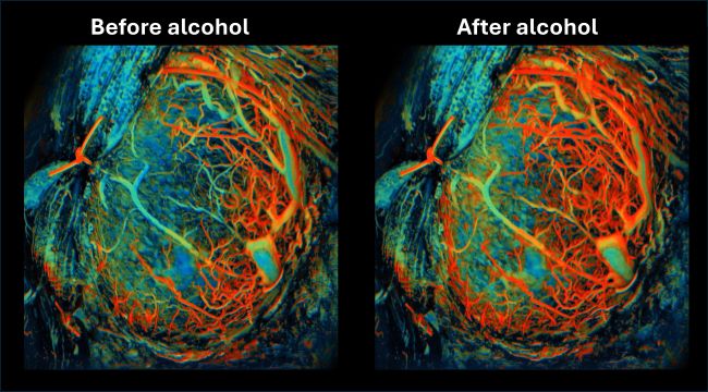 Photoacoustic microscopy image of a mouse placenta, before and after an alcohol challenge