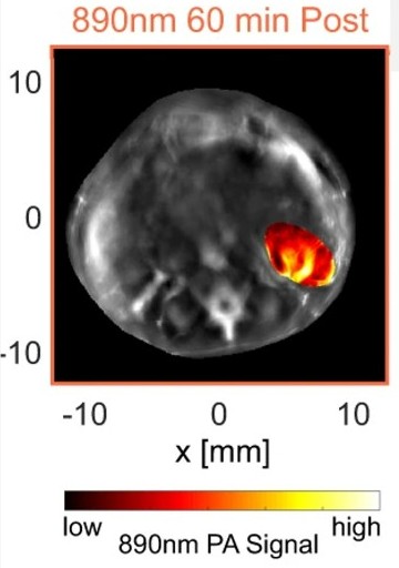 A black and white ultrasound with a bright red and orange area where the contrast agent has settled.