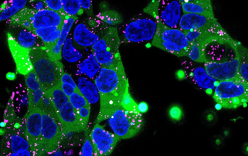 green fluorescent protein delivered into kidney cells