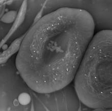 A black and white image of three cells
