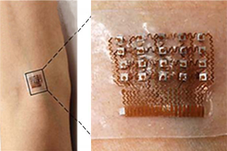 ultrasound patch on arm that measures blood pressure