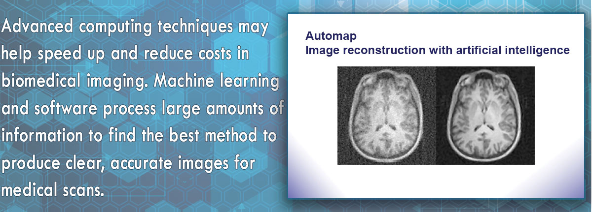blurry versus clear medical scan of the brain