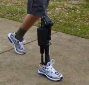 prosthetic robotic joints