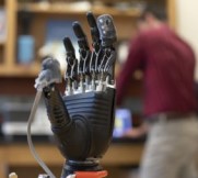 prosthetic hand with sensors for feeling