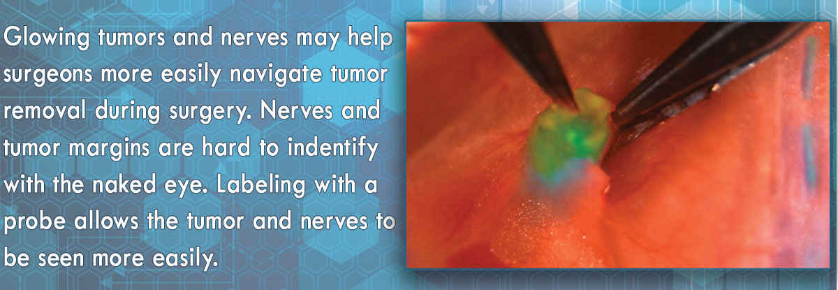fluorescent green, glowing tumor between forceps during surgery