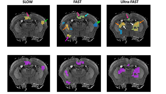 difference in brain tissue stiffness after a stimulus