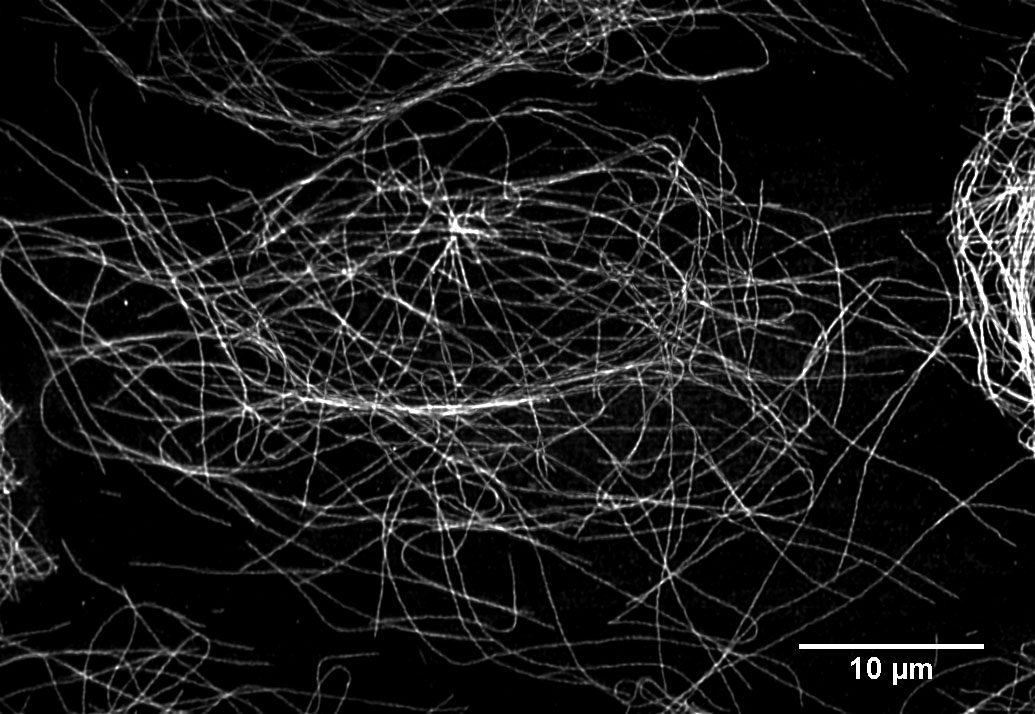 Thi is a picutre of fluorescently labeled microtubules fixed in a cell. The microtubules are less than 150 nm.