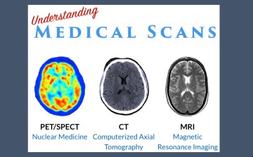 medical scans app brain scans