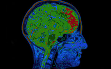 colorful scan of the brain