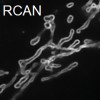 outer mitochondrial membrane of a cell