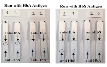 Sickle Cell Disease screening device