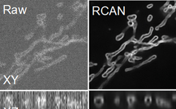 Images of the outer mitochondrial membrane of a cell are difficult to see because of the very low signal to noise ratio (SNR) in the left (Raw) image. Using high power, a much clearer image (known as the ground truth or GT image) can be obtained. At the far right is the image created by the RCAN network, which was shown the raw image and predicted the sharper image.