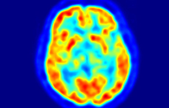 Nuclear Medicine