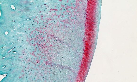 Microscopy image of regenerated cartilage