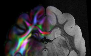 Laboratory on Quantitative Medical Imaging