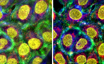 A microscopic image showing yellow circles with a green and blue background