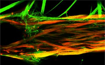 Image of the human neuromuscular junction model