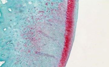 Microscopy image showing cartilage regeneration