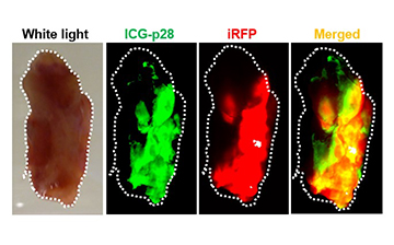 Four panels of an excised tumor. Different panels show how the excised tumor looks under different types of light.