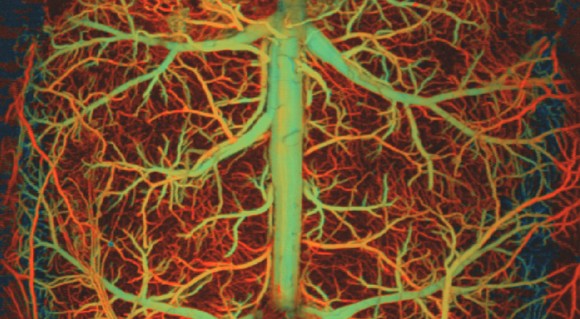 Red and green image of a brain