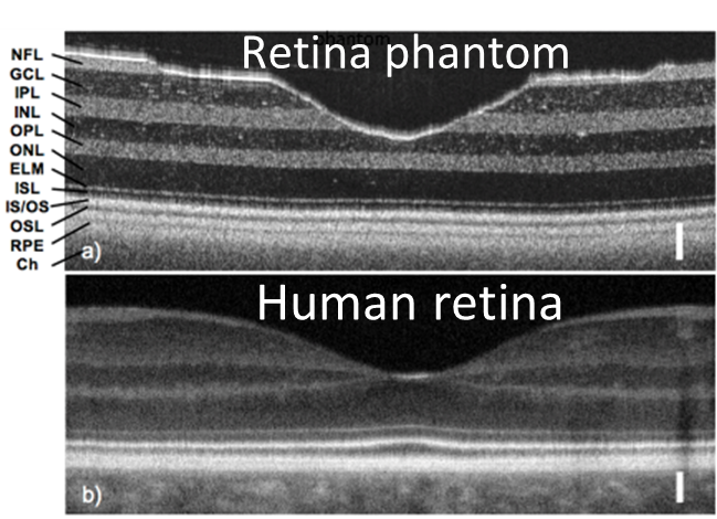 optical coherence tomography images of human retina and phantom retina