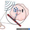 A diagram depicts an ultrasound probe hovering over a tumor on a mouse’s hind leg. A callout box on the right provides a closer look at the tumor and its blood vessels, which contain small bubbles being popped by ultrasound waves.