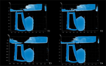 MRI scans of a breast immobilization device being used on phantom breast tissue