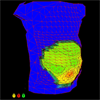 A heat map of a pregnant person’s abdomen, showing uterine muscle activity in hotter colors