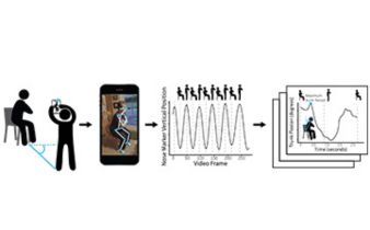 Schematic demonstrating how self-collected data from the sit-to-stand test can be analyzed remotely 