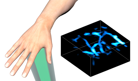 An image showing a digital rendition of a photoacoustic imaging device beaming a laser into a human hand and a 3D medical image on the right of blood flowing through vasculature in the hand