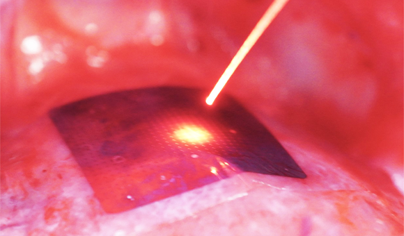 A photo of a thin silicon sheet on an animal heart being struck by a laser beam.