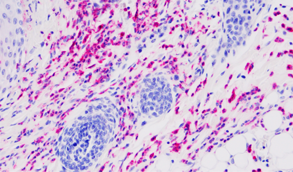 A histological image of mouse tissue stained for neutrophils
