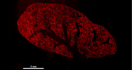 gene editing phd programs Microscopy image of mouse lung with widespread red fluorescence