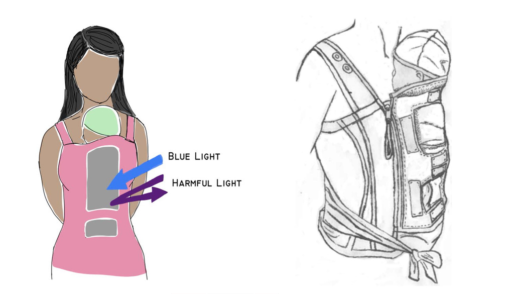 Diagram of the BiliRoo device