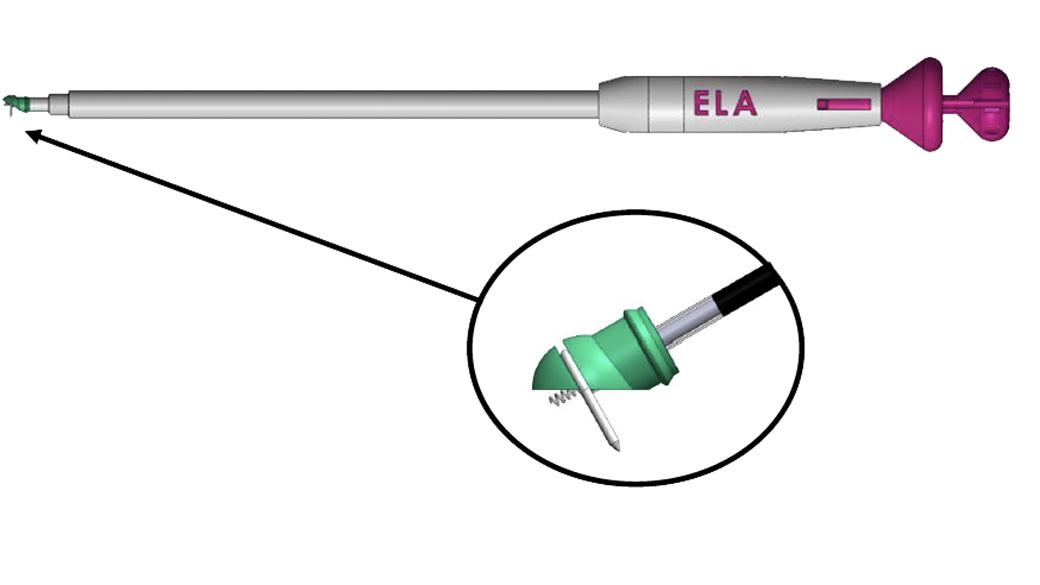 Diagram of the Epicardial device