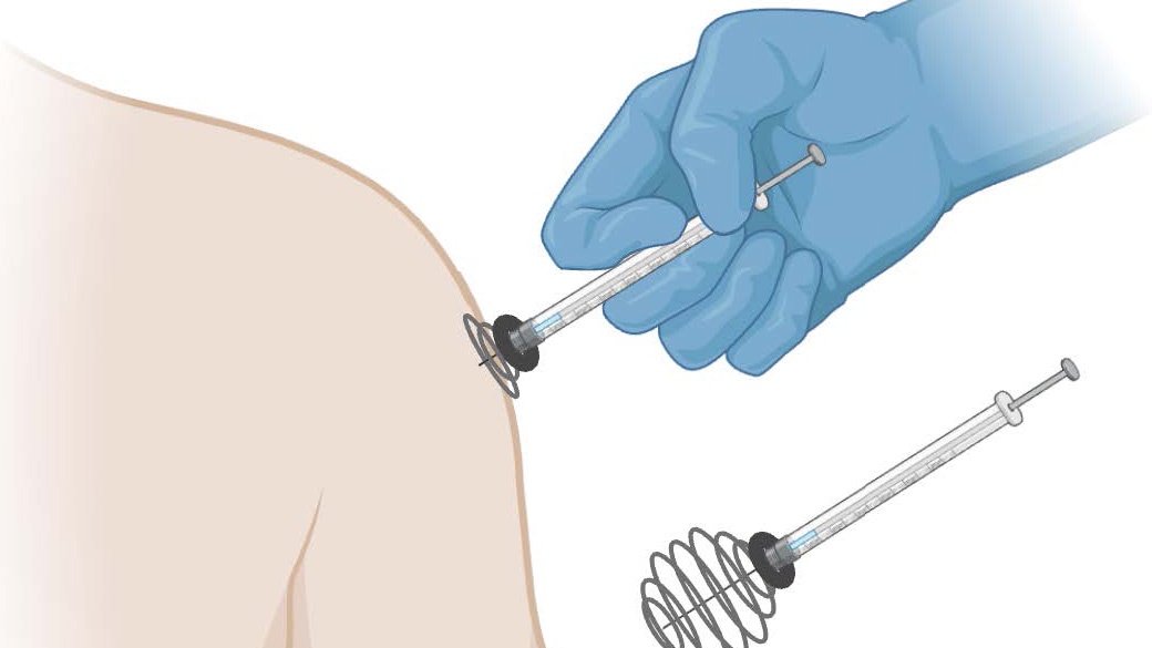 Image of the SafeSpike device