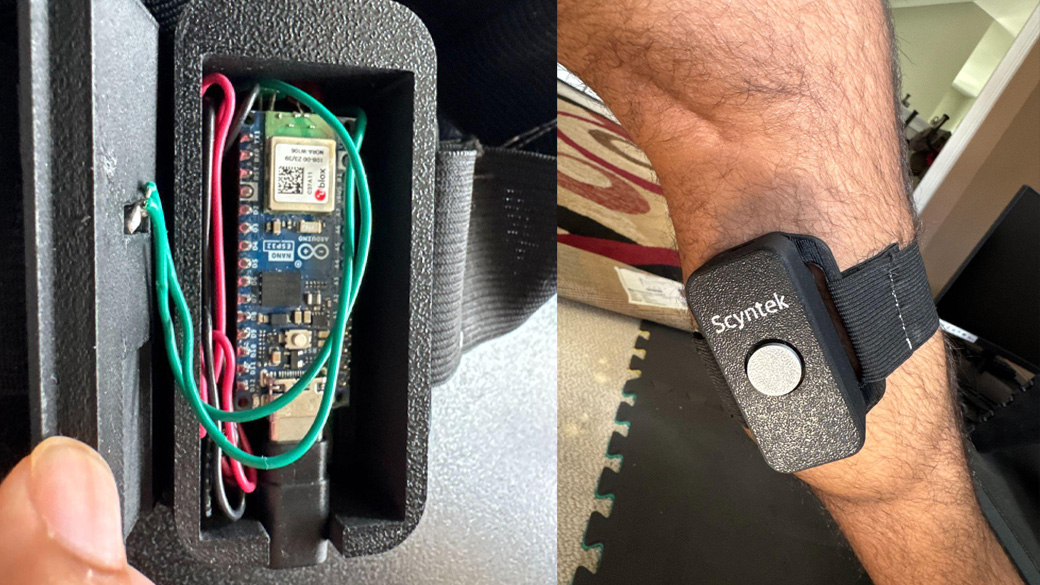Photo of the Scyntek device
