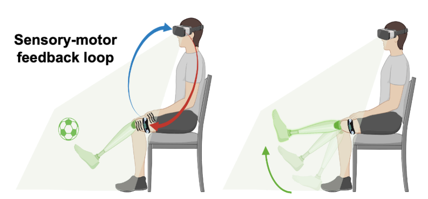 Graphic depicting two versions of seated youth with lower-leg prosthetic, the leftmost receiving sensory-motor feedback.