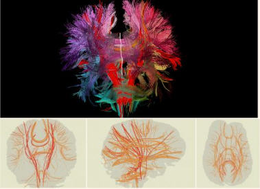 3-D and 2D neural bundles in the brain. (R. Jianu, Brown Univ.) 3-D and 2D neural bundles in the brain. (R. Jianu, Brown Univ.)