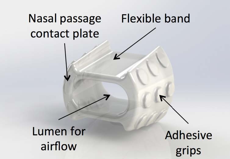 An illustration of the AssistENT