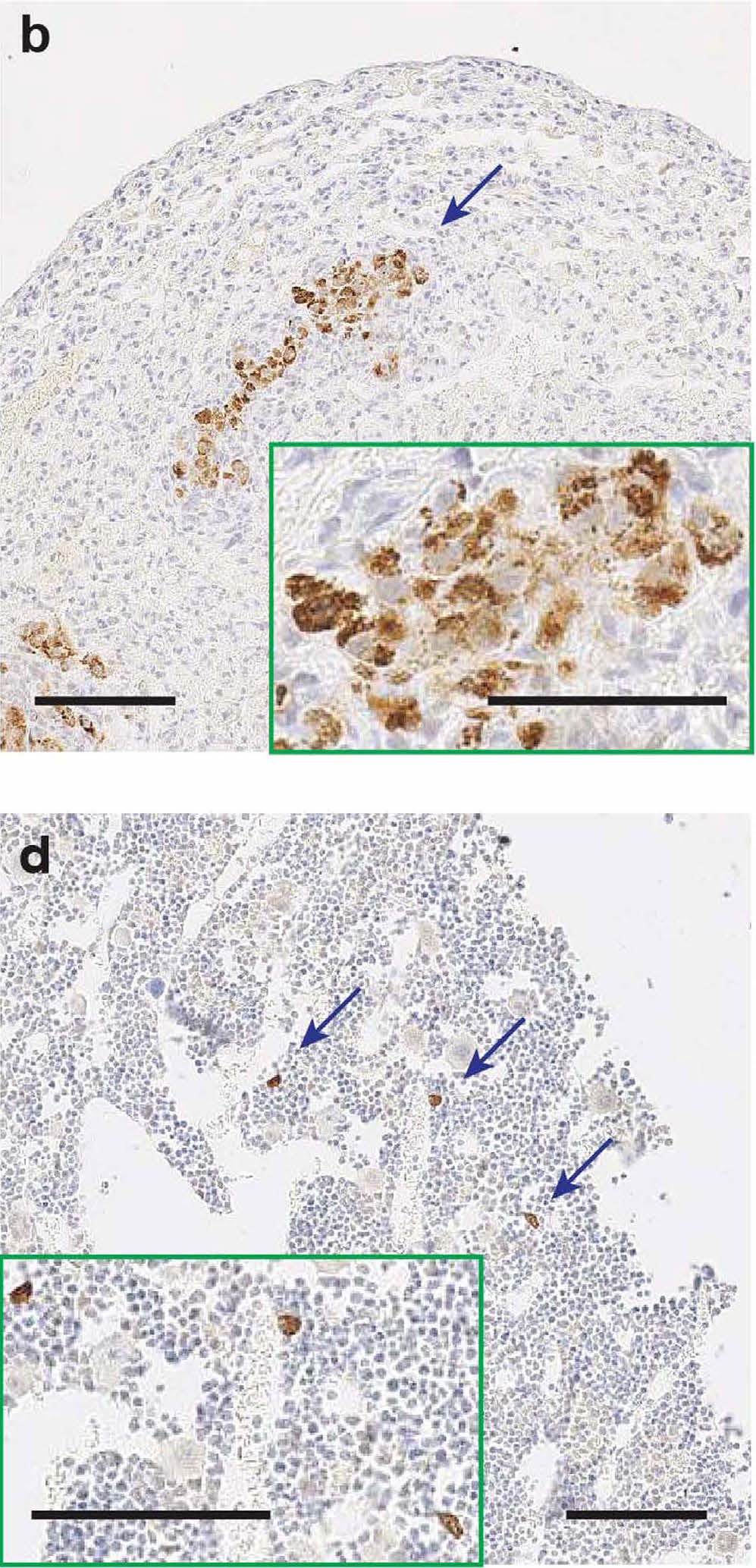 Image of cancer metastasis in mice.
