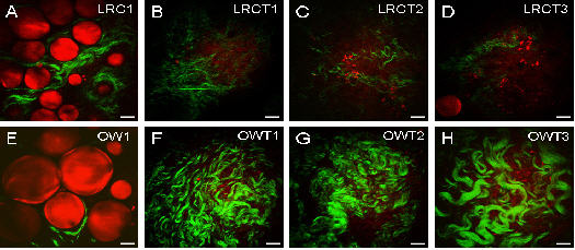 Imágenes por microscopía CARS de células adiposas (rojo) y de fibrillas de colágeno (verde) por SHG (por sus siglas en ingles–Second Harmonic Generation o Generación de Segundo Armónico – otra técnica no lineal), utilizadas para evaluar el impacto de la obesidad en tumores del seno. Las imágenes de la fila superior son de ratas delgadas, mientras que las de la fila inferior son de ratas obesas. La primera imagen de cada fila (A y E) es de glándulas mamarias, mientras que las restantes (B-D y F-H) son del tejido que cubre a los tumores (estroma). Estas imágenes indican que la obesidad está asociada con un contenido reducido de colágeno en las glándulas mamarias y con un incremento en el contenido de colágeno y agresividad en tumores del seno. Escala de barras = 25 um. Imágen de Ignacio Camarillo.