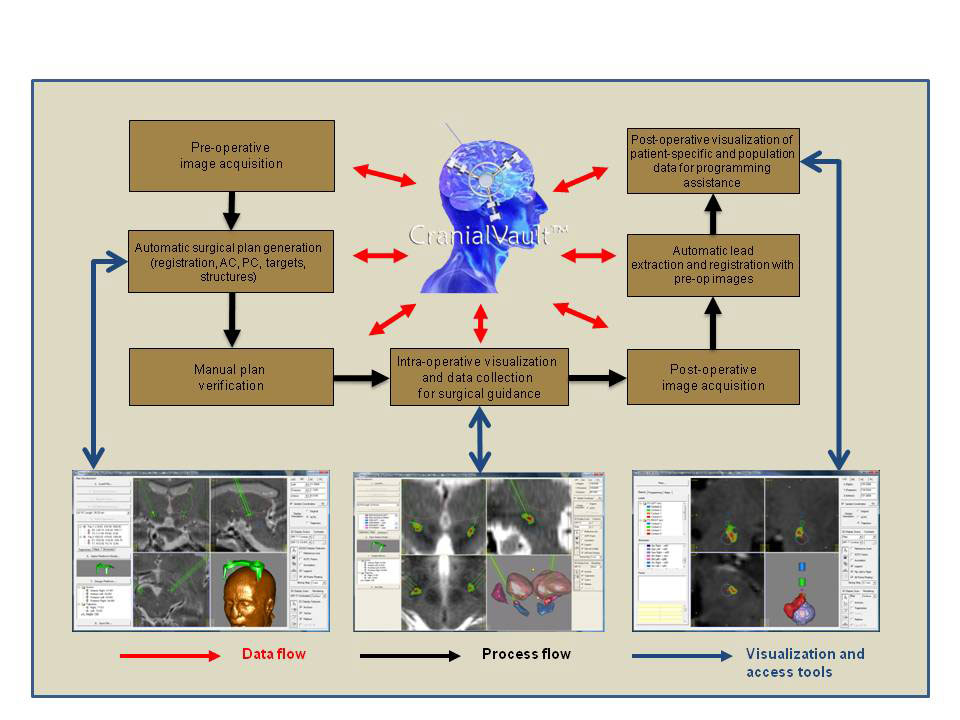 The CranialVault database and CRAVE user interface tools provide access to data from hundreds of patients who have undergone deep brain stimulation surgery. The interface tools help neurosurgeons reduce surgery time by pinpointing optimal sites for electrode implantation and more rapidly programming a patient’s pulse generator to eliminate symptoms associated with movement disorders. The CranialVault database and CRAVE user interface tools provide access to data from hundreds of patients who have undergone deep brain stimulation surgery. The interface tools help neurosurgeons reduce surgery time by pinpointing optimal sites for electrode implantation and more rapidly programming a patient’s pulse generator to eliminate symptoms associated with movement disorders.