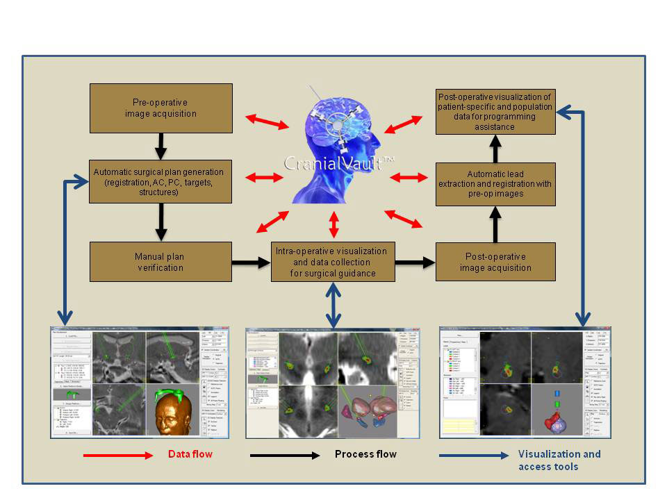 La base de datos CranialVault y las herramientas de interfaz de usuario CRAVE proporcionan acceso a los datos de cientos de pacientes que han sido sometidos a cirugía de estimulación cerebral profunda. Las herramientas de interfaz ayudan a los neurocirujanos a reducir el tiempo de la cirugía señalándole los sitios óptimos para la implantación de electrodos y programando más rápidamente el generador de pulso de un paciente para eliminar los síntomas asociados con los trastornos del movimiento. 