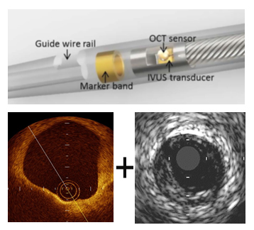 Dual OCT IVUS Catheter