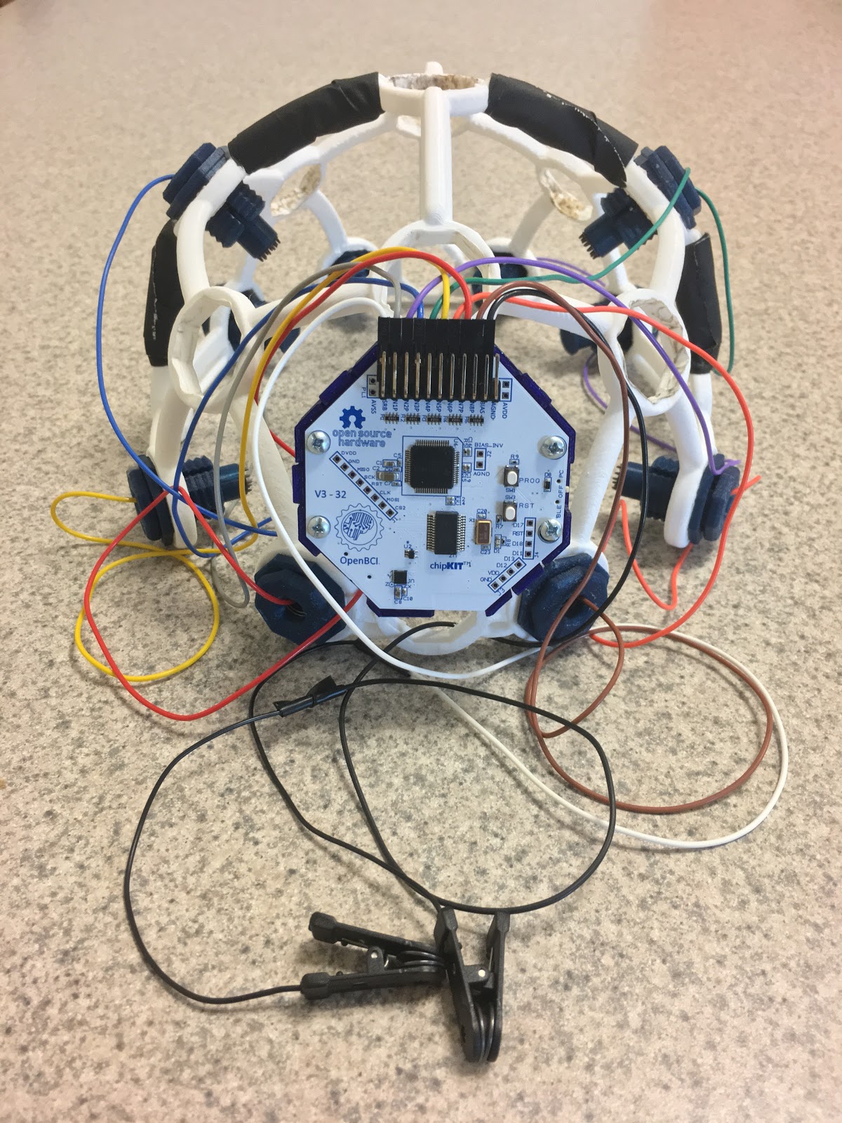 A prototype EEG device that uses an Ultracortex headset by OpenBCI and is designed to help diagnose Alzheimer's disease