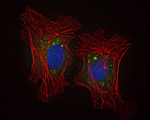 Al entrar en las células, las nanopartículas empiezan a degradarse, despojando su capa de polietilenglicol (verde) y liberando su carga de fármacos. Aquí, el esqueleto de la célula se muestra en rojo, y el núcleo de la célula en azul. El color verde dentro de la célula demuestra que las nanopartículas entraron en la célula.